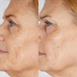 Caudalie Premier Cru - The Rich Cream 5 Caudalie Premier Cru - The Rich Cream -Fenty Beauty caudalie premier cru the rich cream 1