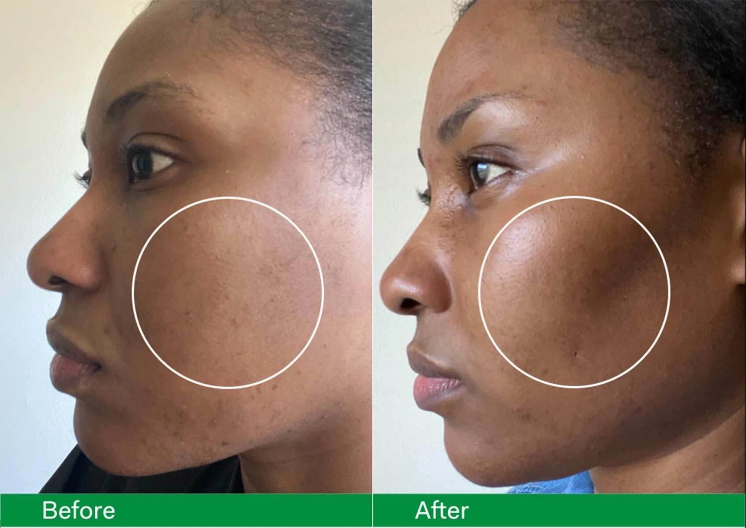 Skin Filter Serum 4 Skin Filter Serum – Bild 4